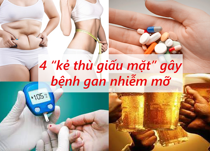 4 "kẻ thù giấu mặt" gây bệnh gan nhiễm mỡ - Ảnh 3. 4 "kẻ thù giấu mặt" gây bệnh gan nhiễm mỡ - Ảnh 3.