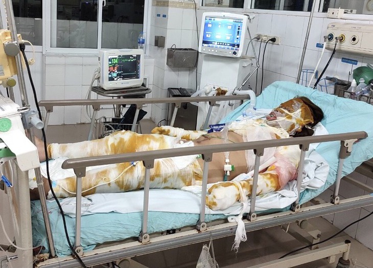 Xót xa mẹ nguy kịch vì bỏng nặng, hai con nhỏ không người chăm sóc phải gửi hàng xóm - Ảnh 2.