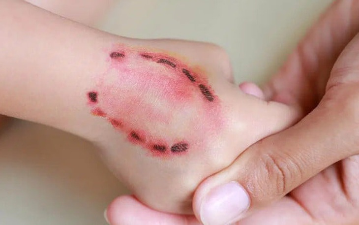 "Thú cưng" nuôi trong nhà cắn 2 trẻ tử vong