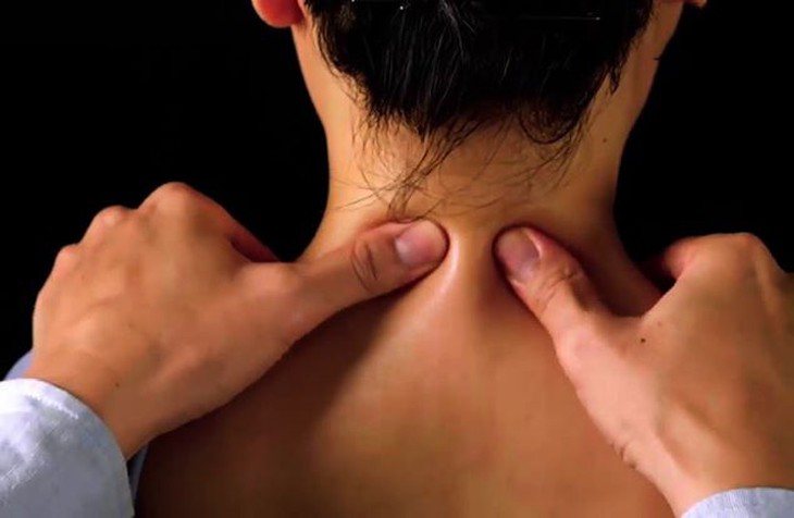 Chữa đau cổ vai gáy bằng phương pháp bấm huyệt - Ảnh 1.
