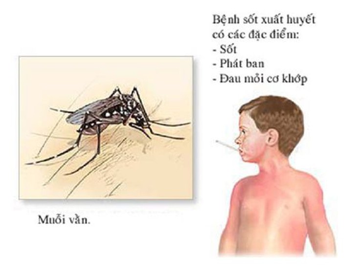 Sốt xuất huyết trẻ em: Triệu chứng và cách chăm sóc cần lưu ý trong dịch COVID-19 - Ảnh 3. Sốt xuất huyết trẻ em: Triệu chứng và cách chăm sóc cần lưu ý trong dịch COVID-19 - Ảnh 3.