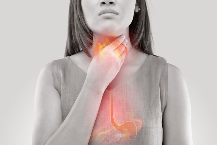 3 điều cầu lưu ý trong bệnh trào ngược họng thanh quản - Ảnh 1.
