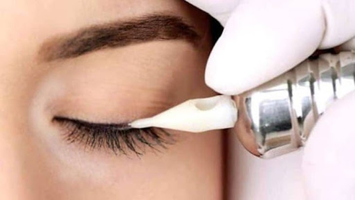 Phun mí mắt làm đẹp cần chú ý điều gì để an toàn? - Ảnh 1. Phun mí mắt làm đẹp cần chú ý điều gì để an toàn? - Ảnh 1.