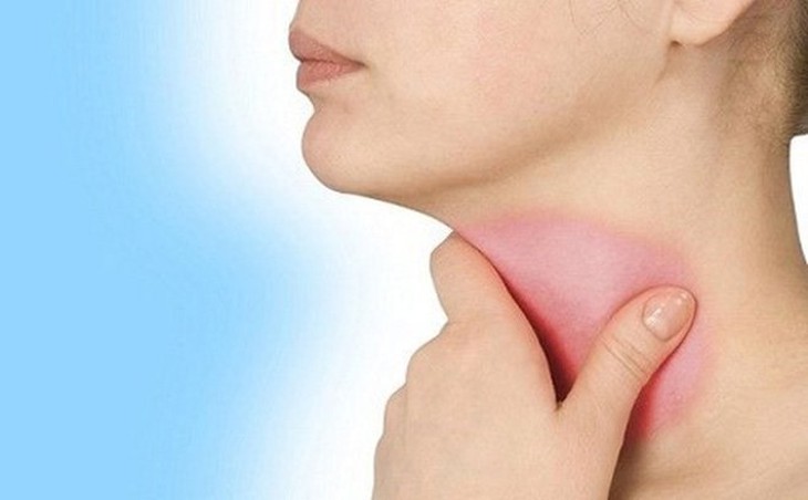 Các biểu hiện của ung thư thực quản - Ảnh 3.