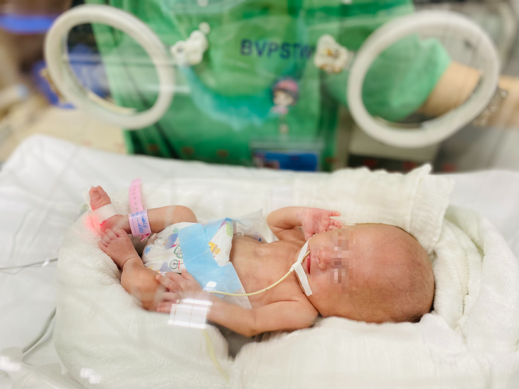 Kỳ diệu, cứu sống và nuôi dưỡng thành công trẻ sơ sinh nặng 400gram đầu tiên tại Việt Nam - Ảnh 1.