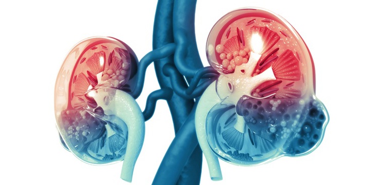 Virus COVID-19 có thể gây tổn thương thận - Ảnh 3.