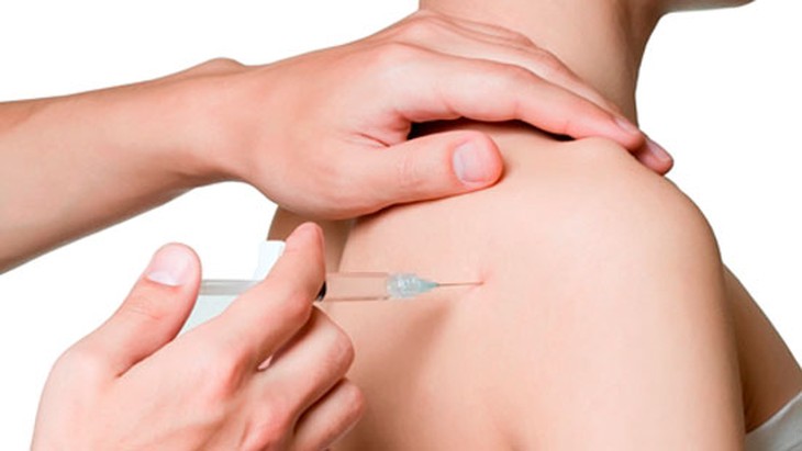 Viêm quanh khớp vai: Nguyên nhân, triệu chứng, chẩn đoán và điều trị - Ảnh 2.