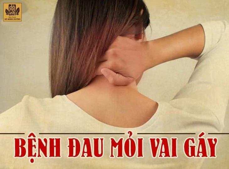 Đau vai gáy là bệnh gì? Nguyên nhân, triệu chứng và cách khắc phục - Ảnh 1.