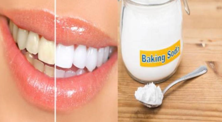 Baking soda có phải là thuốc thần giúp răng trắng sáng và chăm sóc răng miệng? - Ảnh 1.