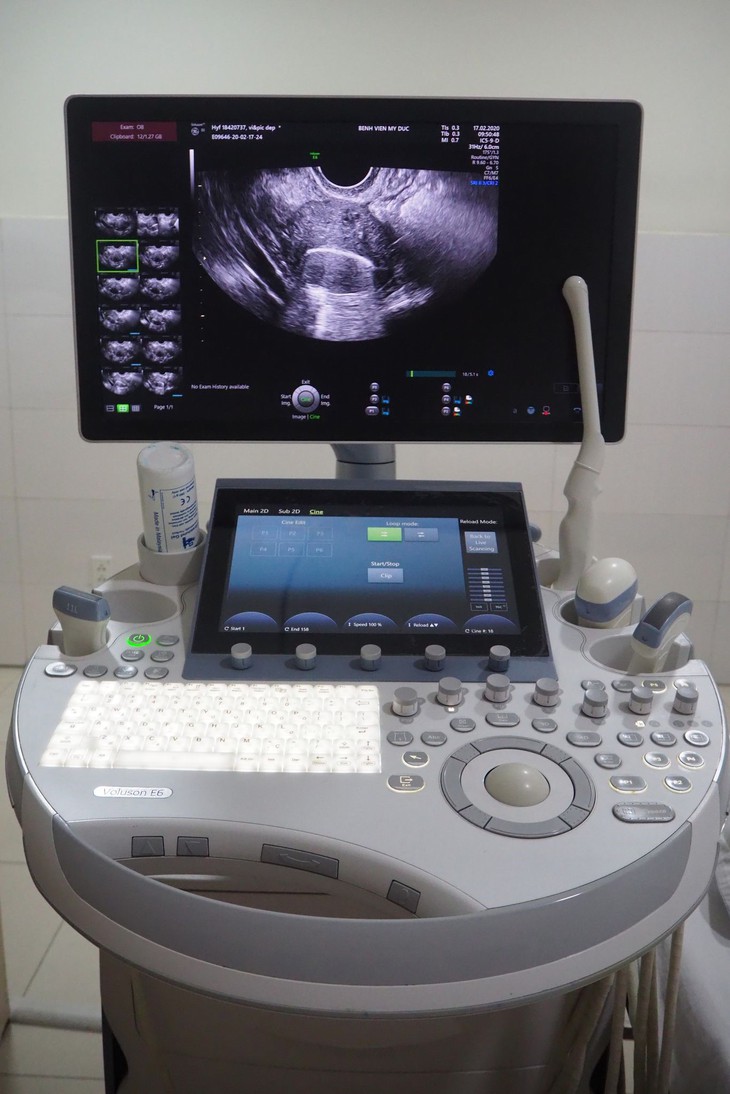 Bệnh viện Mỹ Đức ứng dụng kỹ thuật HyFoSy điều trị bệnh nhân hiếm muộn - Ảnh 1.