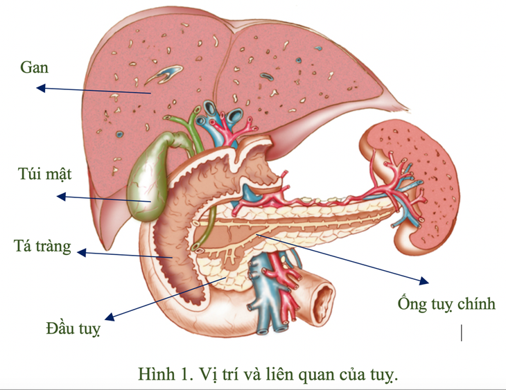 Nguyên nhân, biến chứng bệnh sỏi tụy - Ảnh 2.