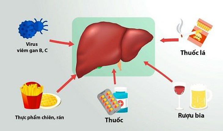 Bí quyết bảo vệ gan trước kỳ nghỉ lễ - Ảnh 2. Bí quyết bảo vệ gan trước kỳ nghỉ lễ - Ảnh 2.