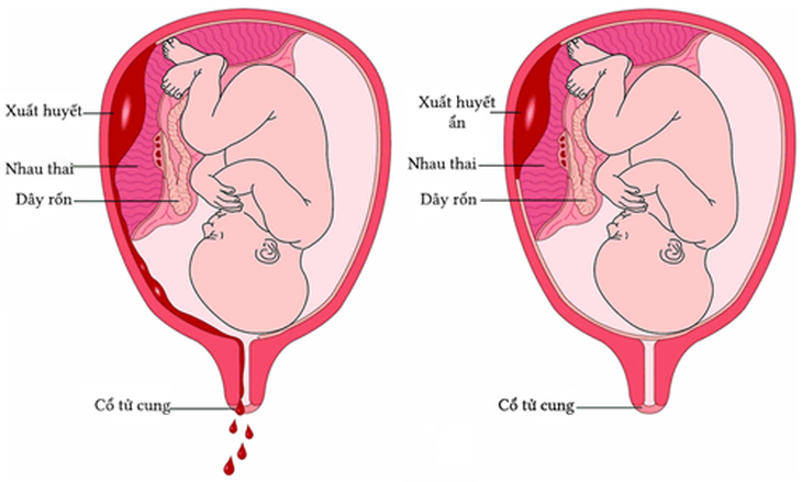 Suy giáp có thể ảnh hưởng như thế nào đến việc mang thai - Ảnh 4. Suy giáp có thể ảnh hưởng như thế nào đến việc mang thai - Ảnh 4.