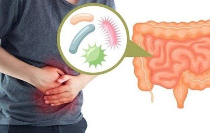 Các triệu chứng của rối loạn tiêu hóa có thể thấy ở cả những người không có hoặc có một bệnh thực thể Các triệu chứng của rối loạn tiêu hóa có thể thấy ở cả những người không có hoặc có một bệnh thực thể