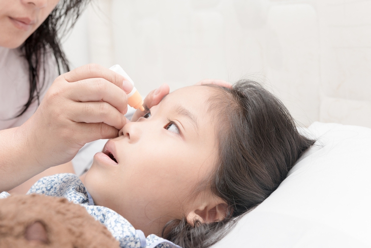Viêm màng bồ đào cấp ở trẻ em: Nhận biết và một số lưu ý cha mẹ cần biết - Ảnh 6.
