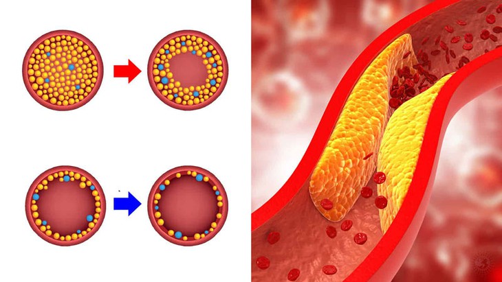 10 thực phẩm hỗ trợ kiểm soát cholesterol cao - Ảnh 2.
