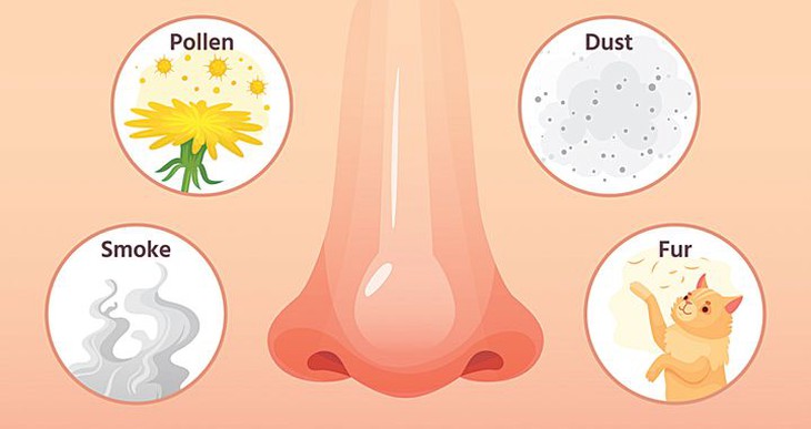 Mùa xuân người viêm mũi dị ứng cần lưu ý những điều sau - Ảnh 1. Mùa xuân người viêm mũi dị ứng cần lưu ý những điều sau - Ảnh 1.