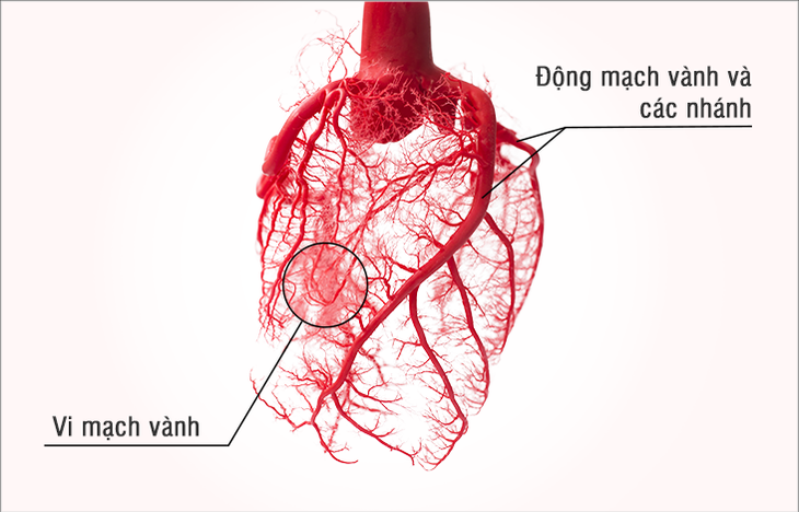 Rối loạn chức năng vi mạch - Nguyên nhân quan trọng gây thiếu máu cơ tim - Ảnh 1. Rối loạn chức năng vi mạch - Nguyên nhân quan trọng gây thiếu máu cơ tim - Ảnh 1.