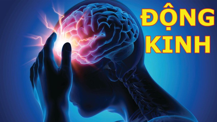 Bệnh động kinh: Cách nhận biết, xử trí và những điều nên tránh - Ảnh 2.