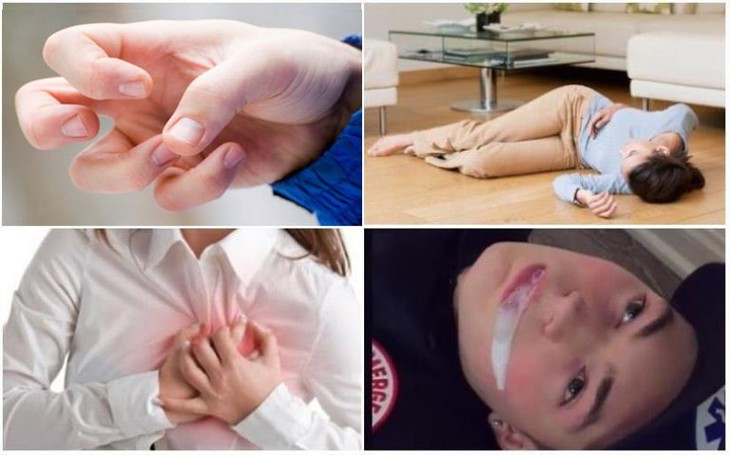 Bệnh động kinh: Cách nhận biết, xử trí và những điều nên tránh - Ảnh 4.