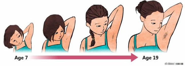 Các giai đoạn phát triển tuổi dậy thì, cách phát hiện dậy thì sớm và phương pháp điều trị - Ảnh 4.