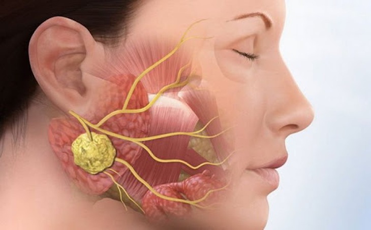 Cũng như nhiều bệnh lý do virus khác gây nên, quai bị không có thuốc điều trị đặc hiệu mà chủ yếu là điều trị triệu chứng, hỗ trợ nâng cao thể trạng của người bệnh và để cơ thể tự hồi phục.