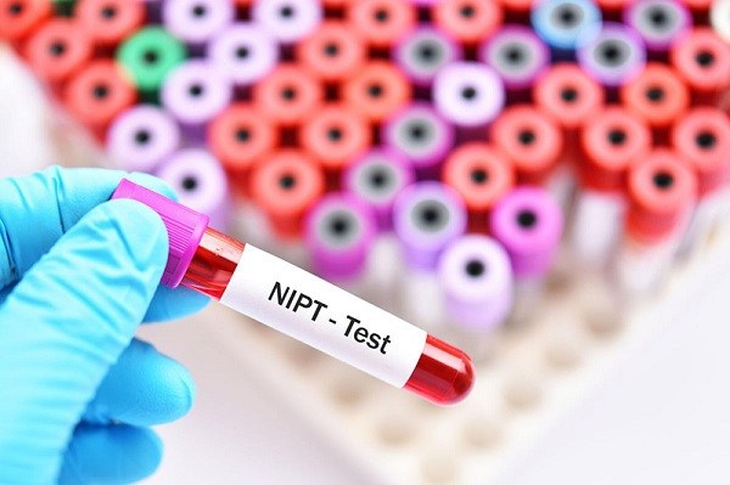 Những tiêu chí quan trọng cần biết khi thực hiện xét nghiệm NIPT - Ảnh 2. Những tiêu chí quan trọng cần biết khi thực hiện xét nghiệm NIPT - Ảnh 2.