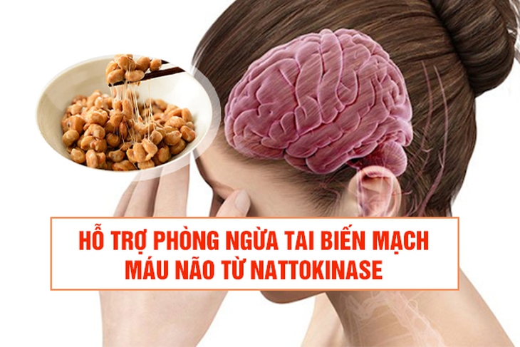 Giải pháp hỗ trợ phòng ngừa tai biến mạch máu não từ nattokinase - Ảnh 2.
