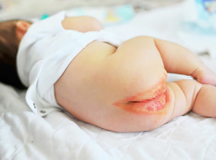 Cảnh báo sức khỏe con trẻ: Cẩn trọng khi lựa chọn tã bỉm không rõ nguồn gốc - Ảnh 3.