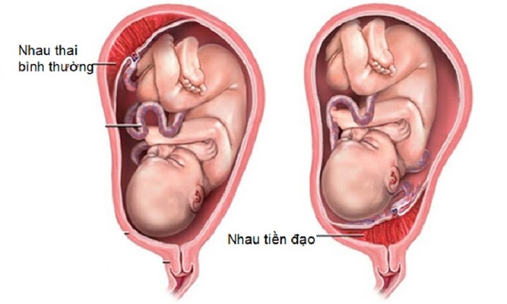 Chảy máu sau khi quan hệ tình dục khi đang mang thai có lo lắng? - Ảnh 2.