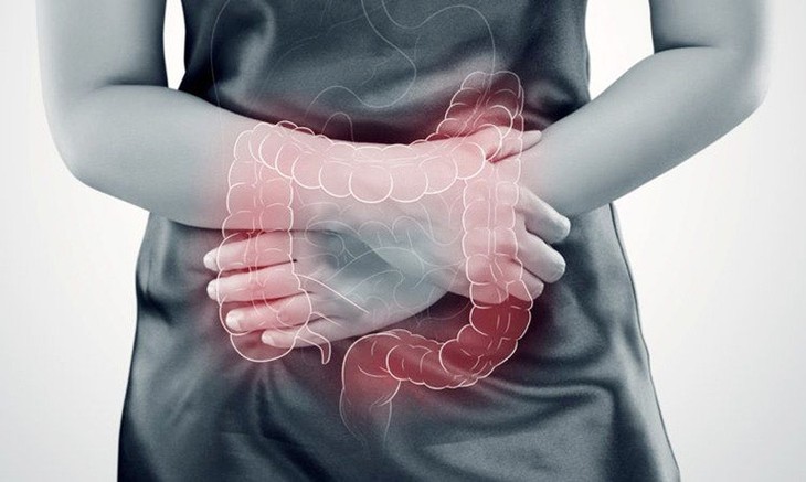 Hỗ trợ bảo vệ đại tràng bằng TPBVSK có nguồn gốc từ thiên nhiên - Ảnh 2. Hỗ trợ bảo vệ đại tràng bằng TPBVSK có nguồn gốc từ thiên nhiên - Ảnh 2.
