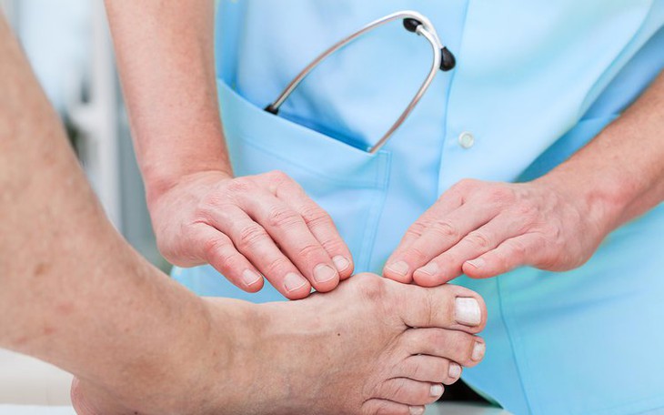 Những sai lầm thường gặp ở người bệnh gout