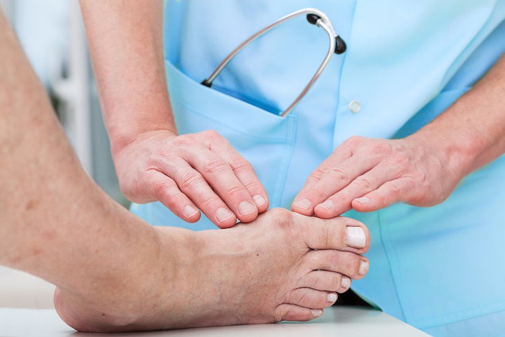 Những sai lầm thường gặp ở người bệnh gout - Ảnh 4.