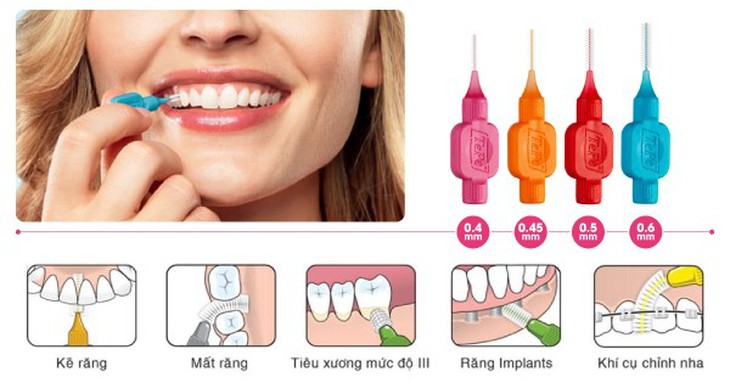 Tại sao cần phải chăm sóc răng miệng đúng cách? - Ảnh 2.