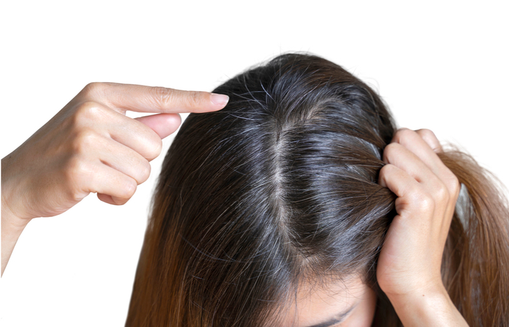 Dầu gội phủ bạc: giải pháp "giữ gìn thanh xuân" tạm biệt mái tóc hoa râm - Ảnh 1. Dầu gội phủ bạc: giải pháp "giữ gìn thanh xuân" tạm biệt mái tóc hoa râm - Ảnh 1.