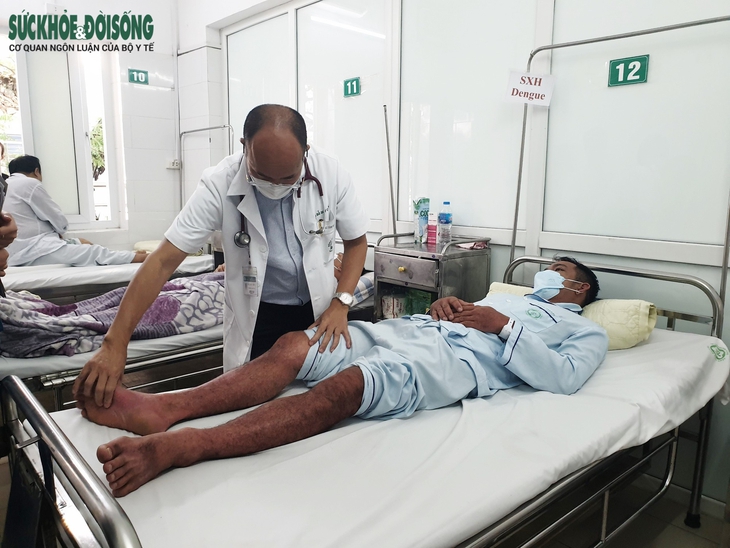 Nhiều người sốt xuất huyết giảm tiểu cầu nghiêm trọng, bác sĩ chỉ rõ dấu hiệu cảnh báo sớm - Ảnh 2. Nhiều người sốt xuất huyết giảm tiểu cầu nghiêm trọng, bác sĩ chỉ rõ dấu hiệu cảnh báo sớm - Ảnh 2.