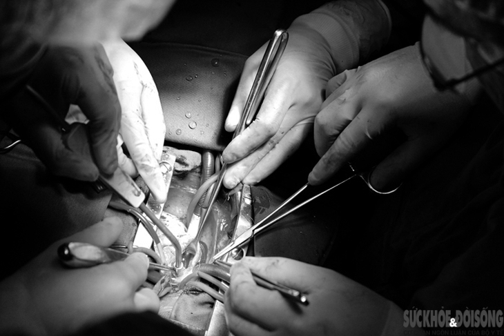 Cứu sống bệnh nhân bị vết thương tim lớn, ngừng tuần hoàn - Ảnh 3. Cứu sống bệnh nhân bị vết thương tim lớn, ngừng tuần hoàn - Ảnh 3.