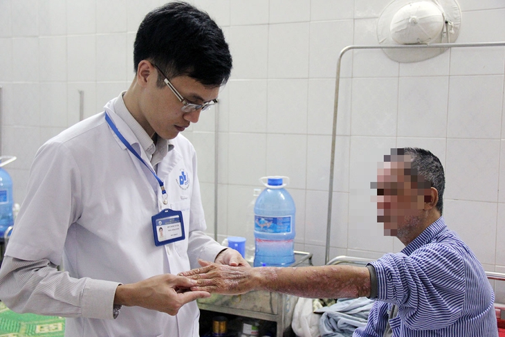 Khốn khổ căn bệnh khiến người mắc phải 'dọn vảy' khi ngủ dậy - Ảnh 2.