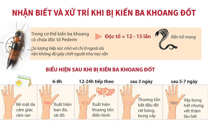 Nhận biết và xử trí khi bị kiến ba khoang đốt