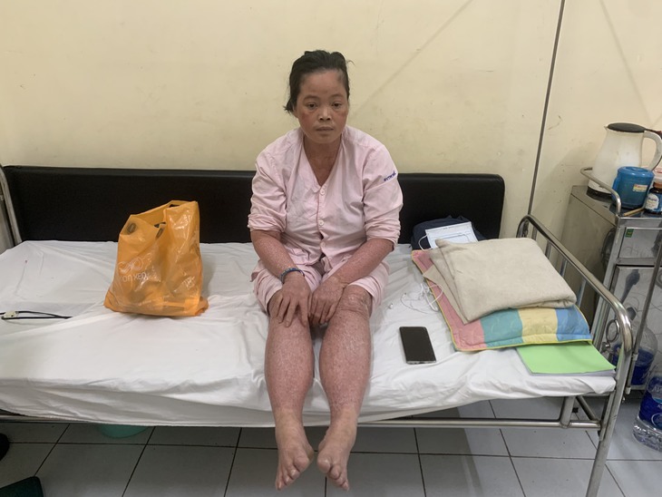 Xót thương người phụ nữ mang trong mình căn bệnh hiếm gặp, sống neo đơn, không có tiền chữa trị - Ảnh 1. Xót thương người phụ nữ mang trong mình căn bệnh hiếm gặp, sống neo đơn, không có tiền chữa trị - Ảnh 1.