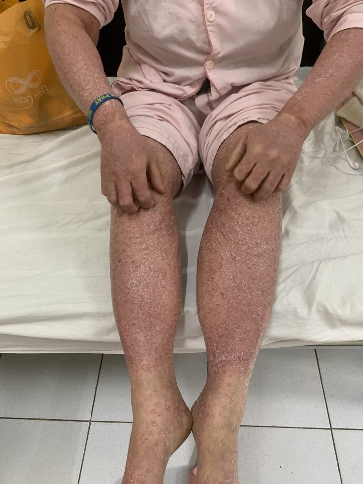 Xót thương người phụ nữ mang trong mình căn bệnh hiếm gặp, sống neo đơn, không có tiền chữa trị - Ảnh 2. Xót thương người phụ nữ mang trong mình căn bệnh hiếm gặp, sống neo đơn, không có tiền chữa trị - Ảnh 2.