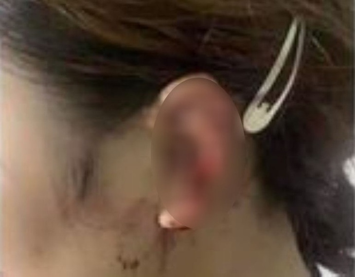 Vụ người phụ nữ đạp vỡ kính ô tô nghi đánh ghen: Có thể đối diện 3 tội danh - Ảnh 2.