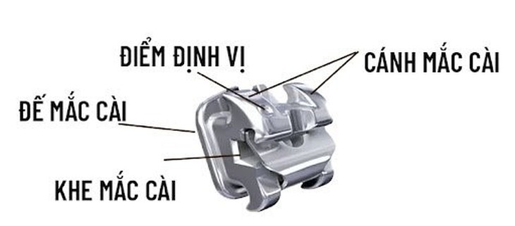 Mách bạn mắc cài nào tốt nhất, tiết kiệm chi phí cho sinh viên - Ảnh 2.