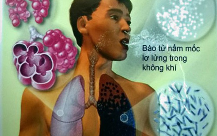 Bệnh nấm - mối đe dọa sức khoẻ toàn cầu