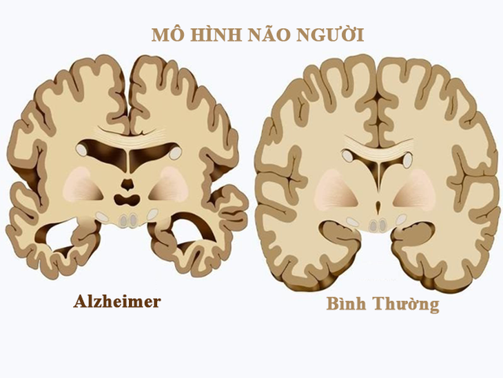Nghiên cứu việc sử dụng tacrine cho các bệnh rối loạn thần kinh - Ảnh 1.