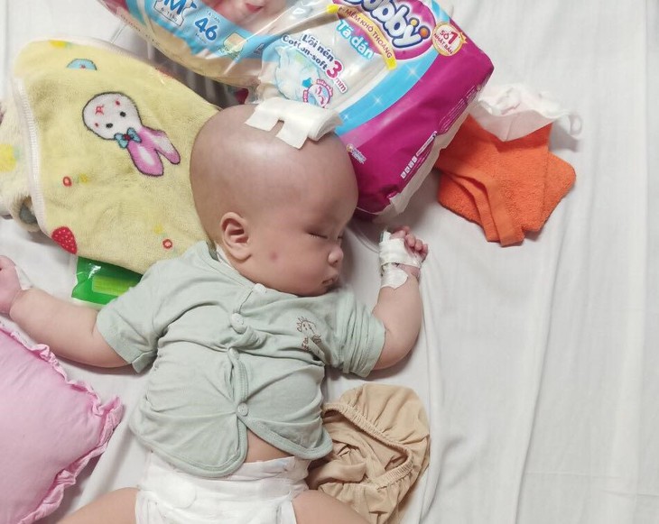 MS 798: Xót xa bé trai đầu biến dạng vì bệnh tật, mẹ nghèo mong con sớm được phẫu thuật - Ảnh 2.