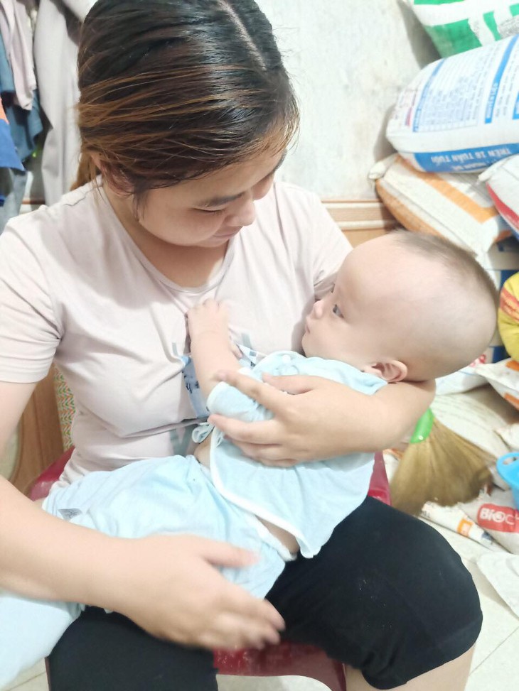 MS 798: Xót xa bé trai đầu biến dạng vì bệnh tật, mẹ nghèo mong con sớm được phẫu thuật - Ảnh 1.