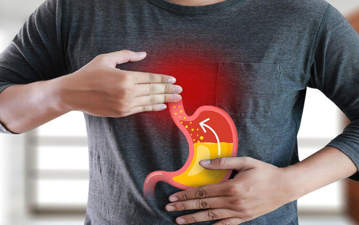 Những thực phẩm giàu chất xơ tốt cho người bệnh trào ngược dạ dày- thực quản