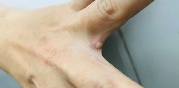 Bệnh viện đầu ngành truyền nhiễm chuẩn bị ứng phó với đậu mùa khỉ - Ảnh 2.
