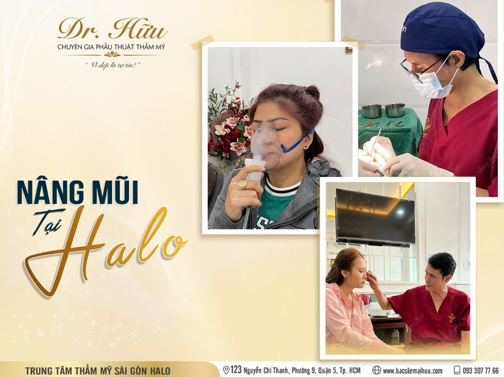 Nâng mũi đẹp tự nhiên bởi bác sĩ thẩm mỹ Lê Mai Hữu - Ảnh 1.